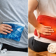 Ice or Heat for Sciatica? What Helps Most