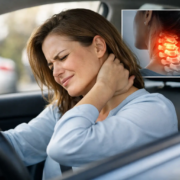 Top Signs of Whiplash You Shouldn’t Ignore